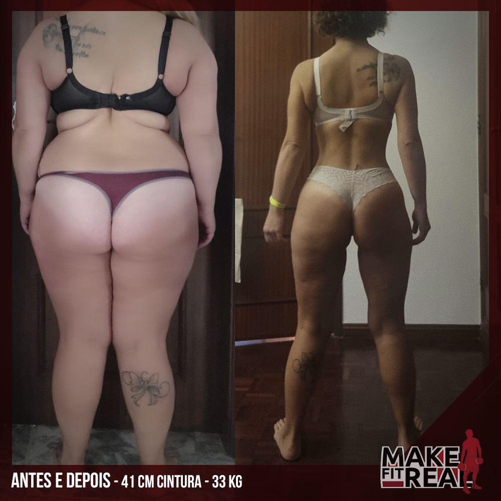 antes e depois_Marcia Esteves 2025 costas
